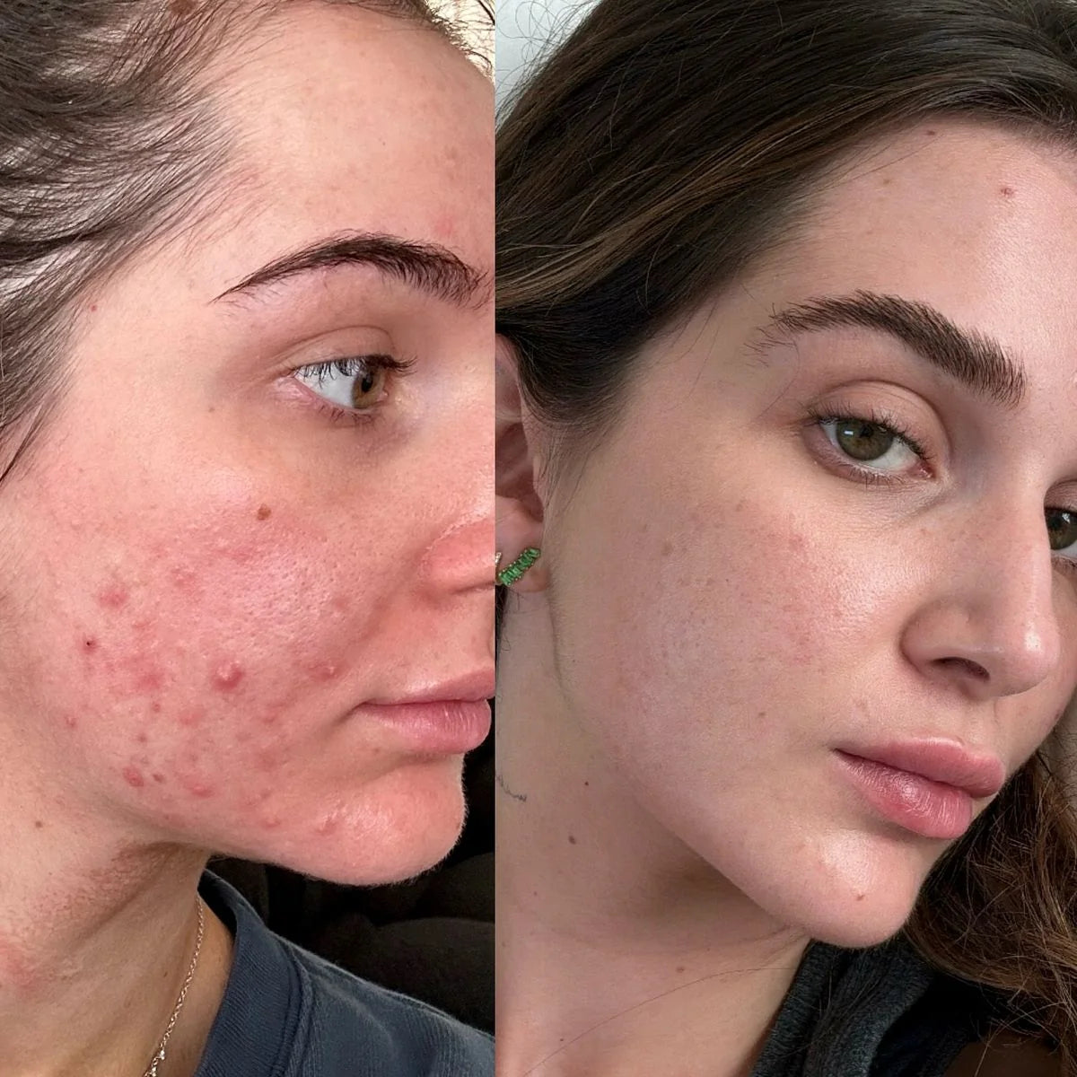 Customer result