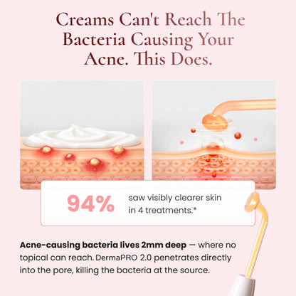DermaPRO 2.0 - High Frequency Wand
