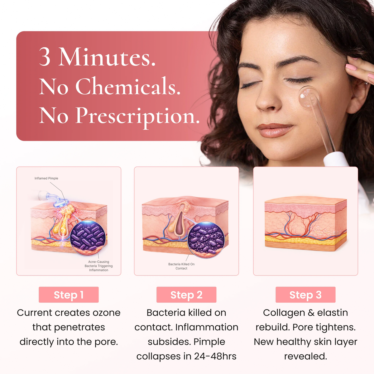DermaPRO 2.0 - High Frequency Wand
