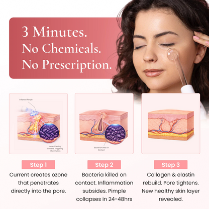 DermaPRO 2.0 - High Frequency Wand